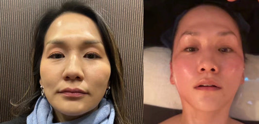 Secret to Korean Celebrities' Tiny Youthful Faces: My Visit to YJ Spa in Seoul